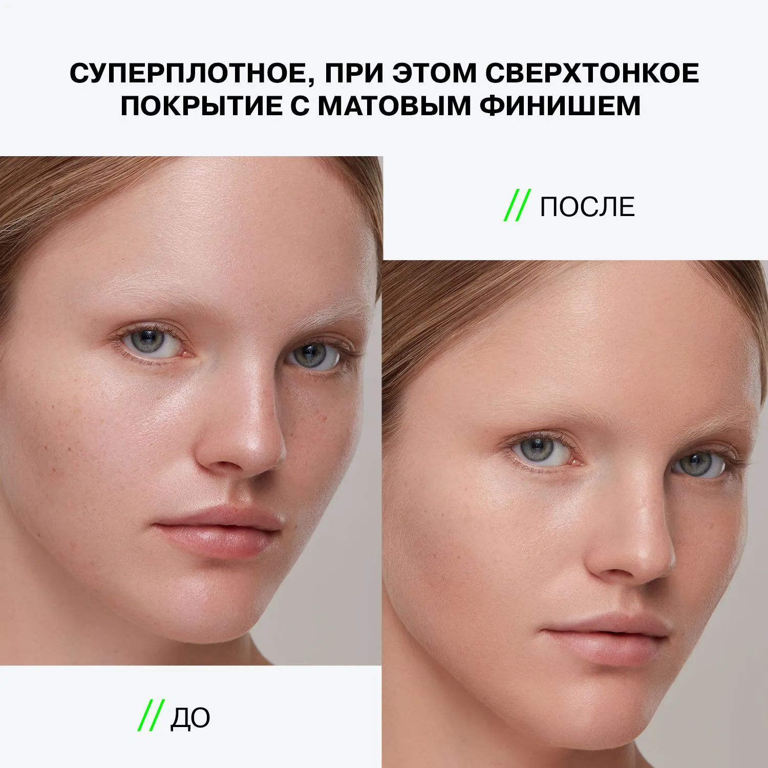 Ekso Skin