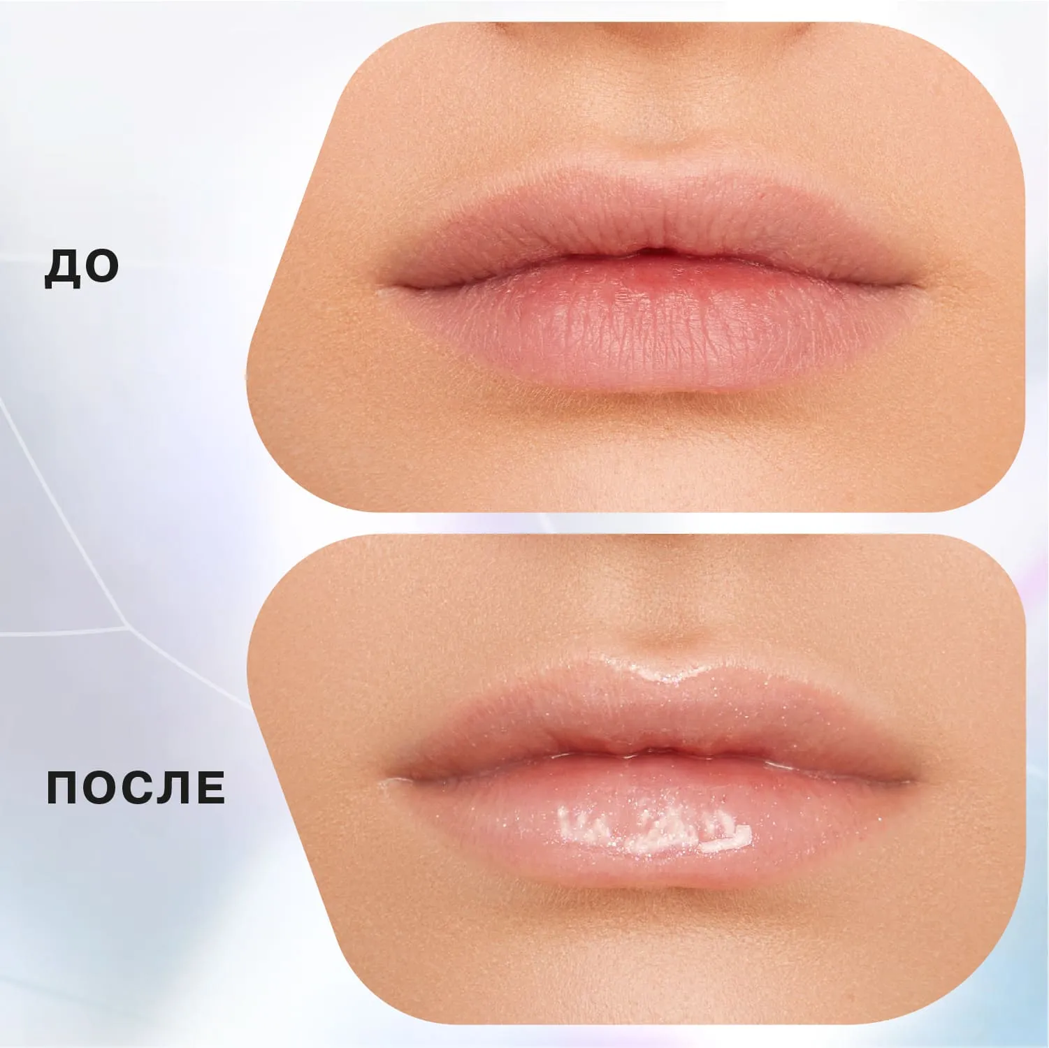 Lip balm jelly
