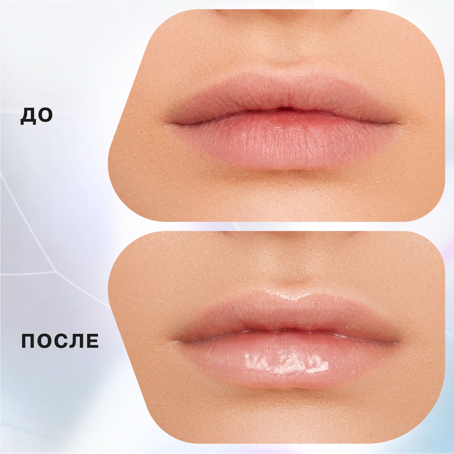 Lip gloss