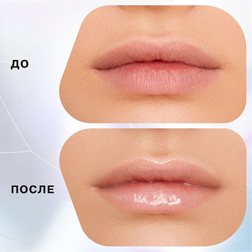 Lip balm jelly